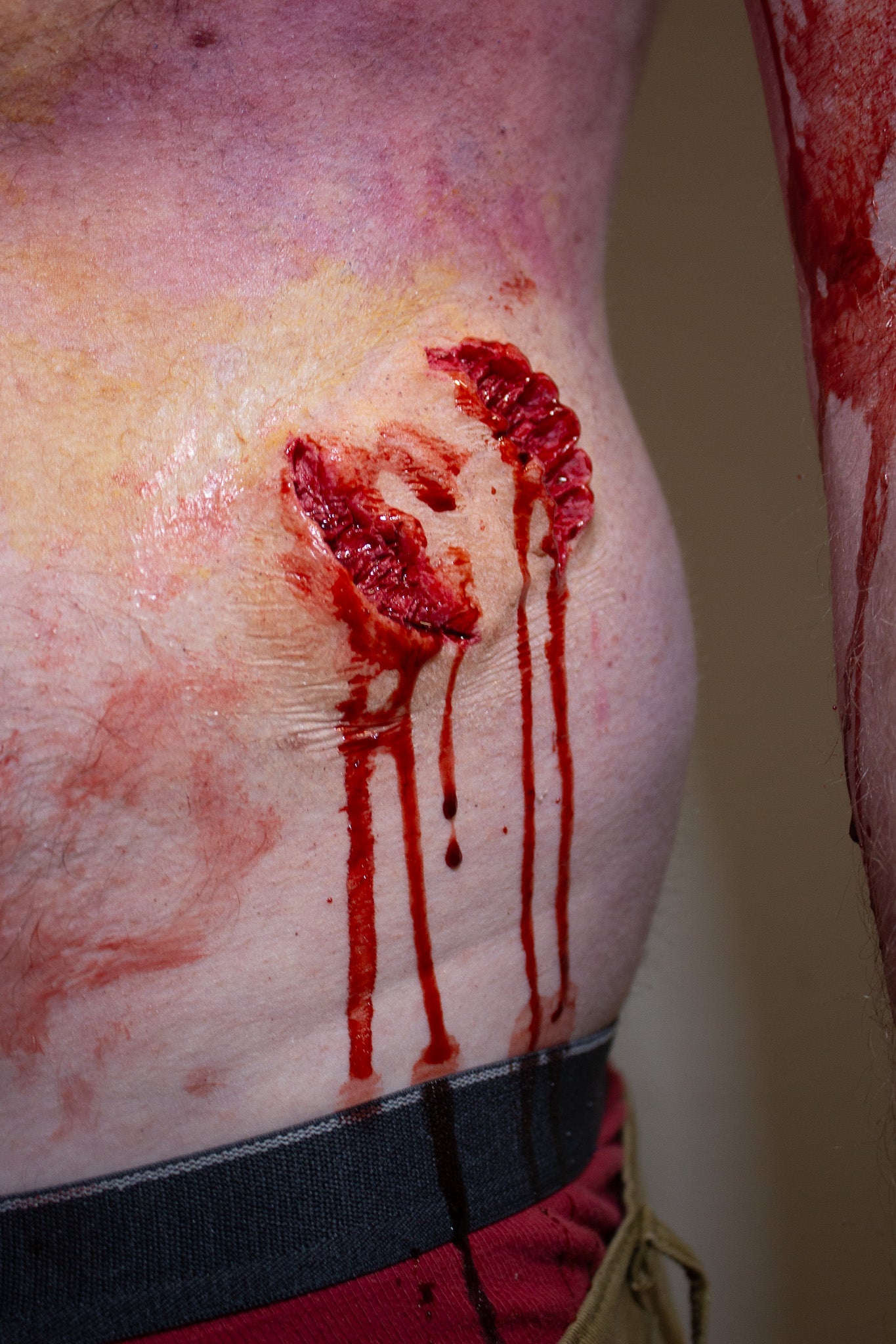 Bite #2