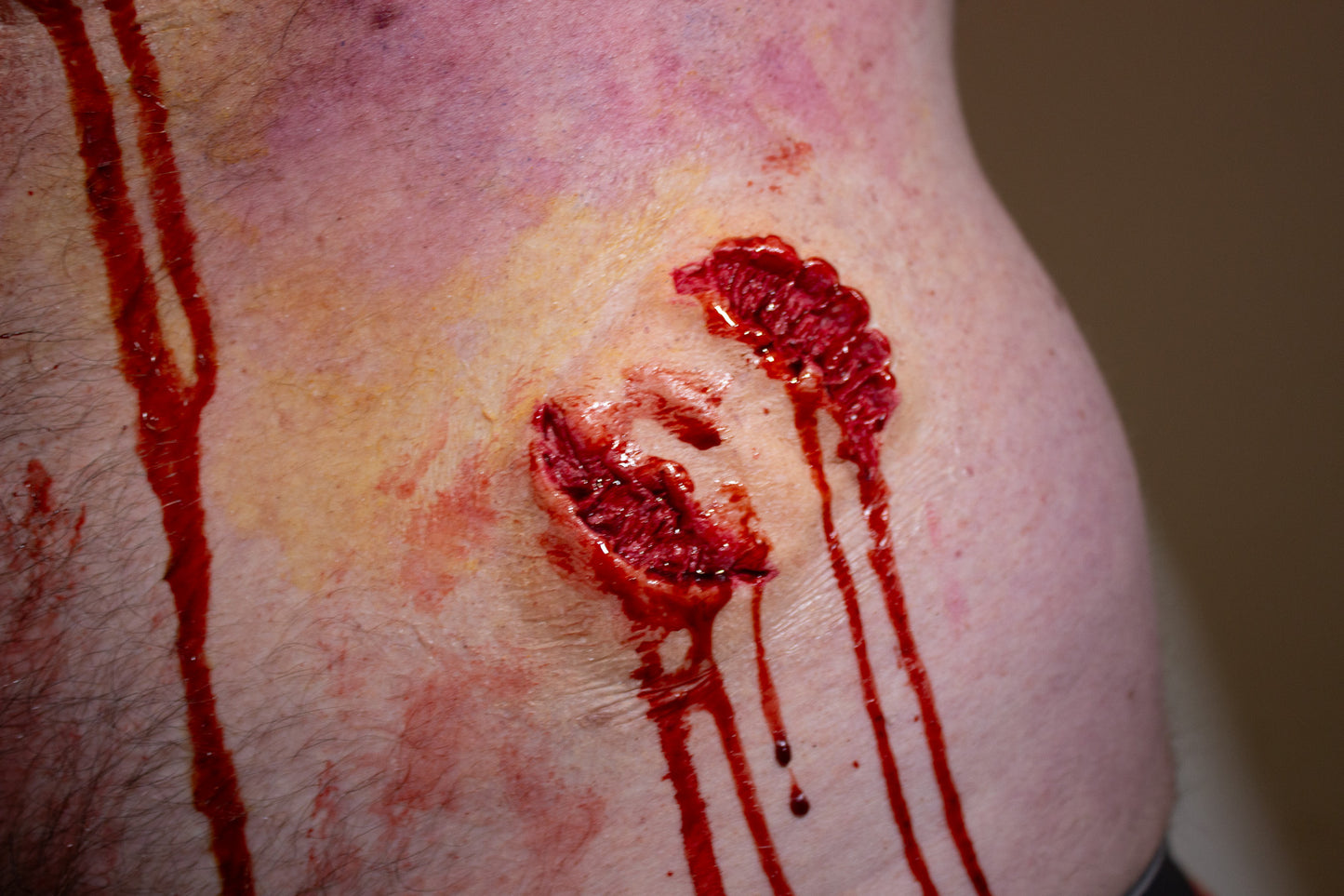 Bite #2