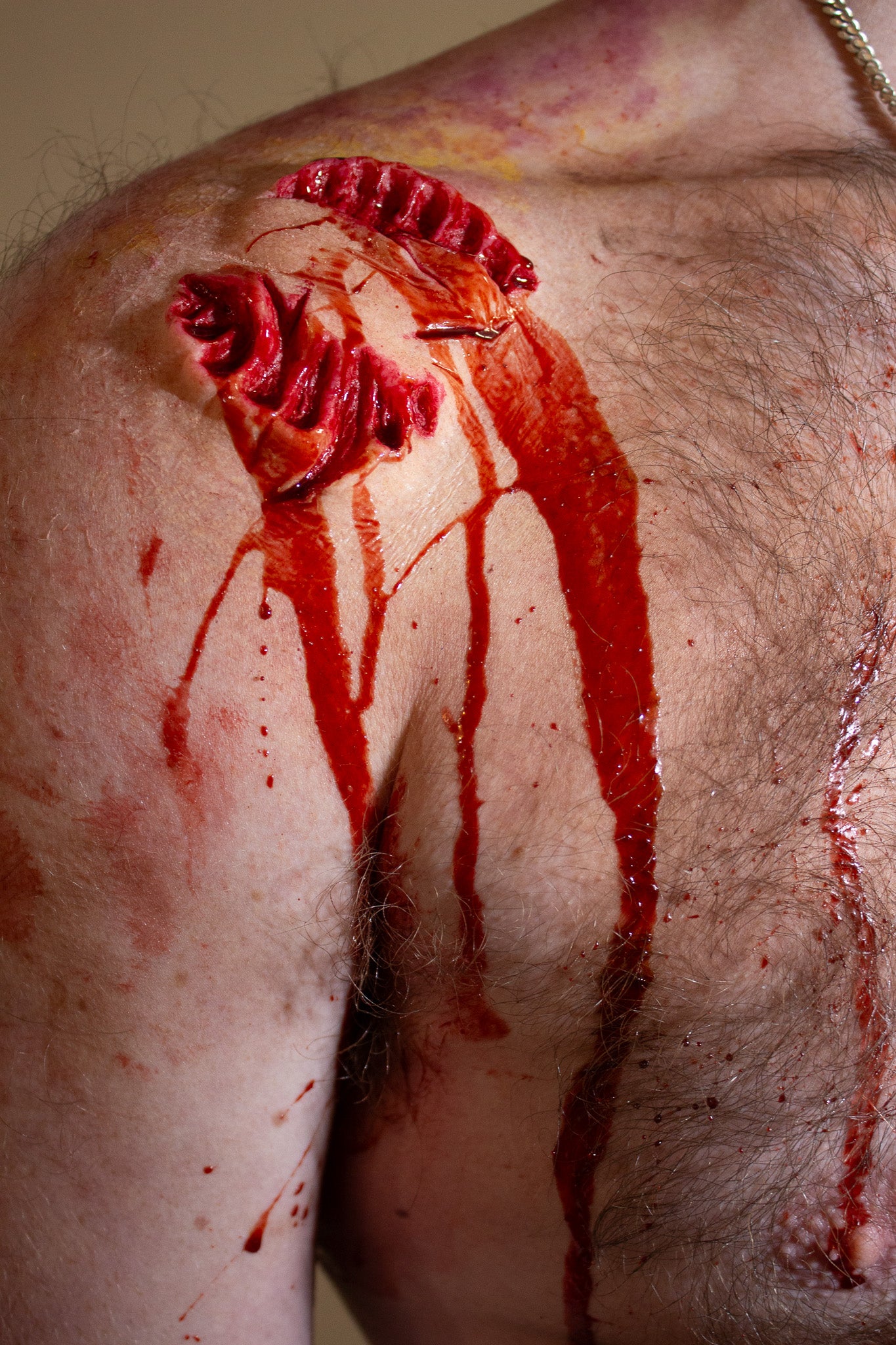 Bite #1