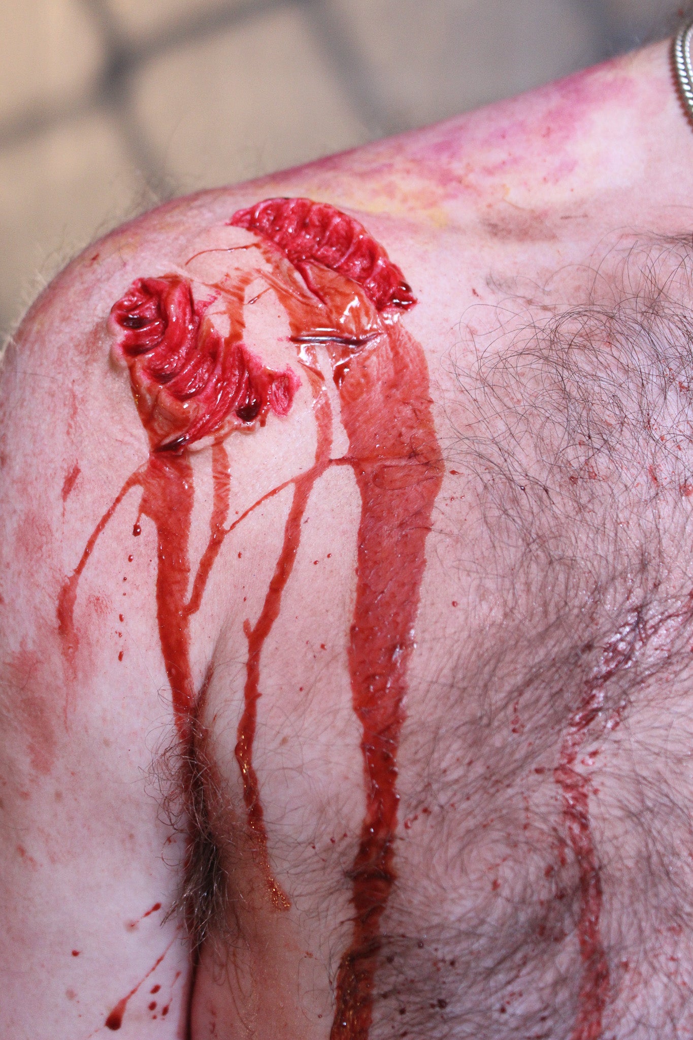 Bite #1
