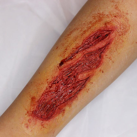 Torn Skin